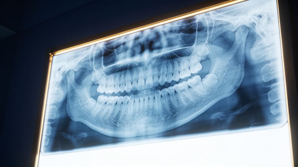 Radiografía dental que muestra la raíz del diente